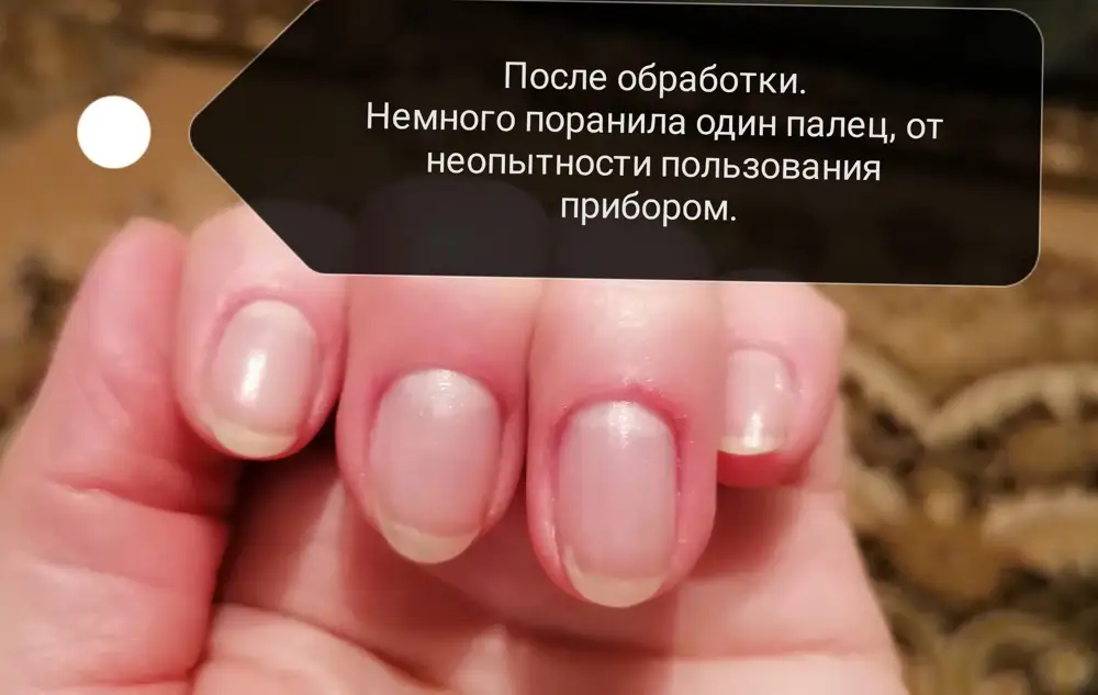 Пилка просто чудо! Даже в первый раз эффект превзошёл все ожидания, так как довольно скептически отнеслась к сухому процессу обработки, который был в описании. Но очень рада, что ошиблась. Маникюр всю жизнь делаю сама, с юности, это 70-е годы. У меня толстая кутикула, которая растёт с астрономической скоростью, и спасал только обрезной способ. Этой пилкой обработала обе руки примерно за 40 минут, без навыка, и немного задела кожу на одном пальце, но не сильно травматично. Очень хорошо обрабатывает кожу вокруг ногтя, не нужно обрезать. Думаю, потом это будет вообще отлично. Советую всем, кто делает все сам, обязательно к приобретению.
