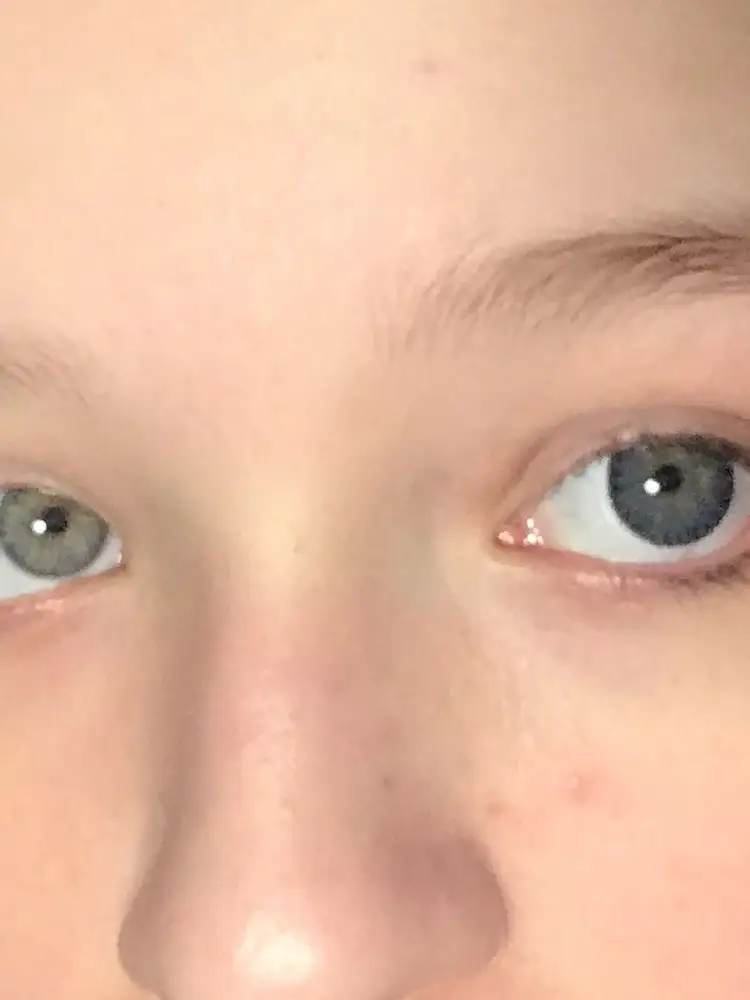 Вообще не заметны и ночка очень дискомфортна